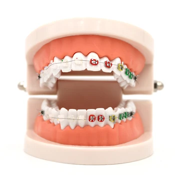 Zobu Ortodontiskās Ārstēšanas Modeli Ar Keramikas Turētājs Arch Vadu Orto Metāla Ortodontijas Zobiem Zobu Protēžu Modelis